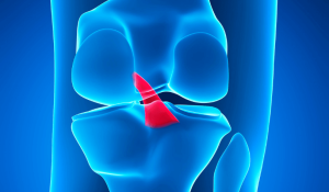 knee with acl ligament highlighted