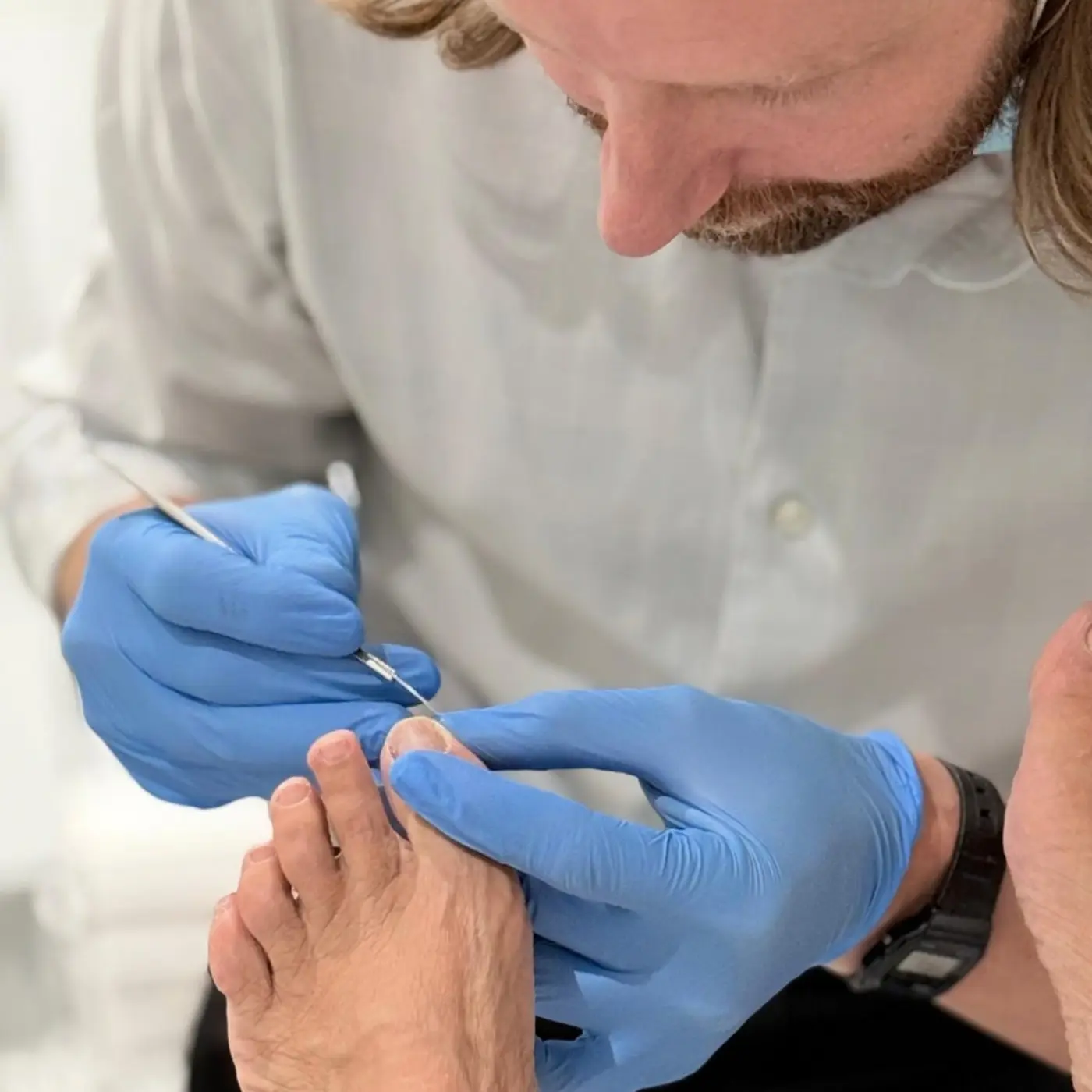 Podiatrist at Nordic Balance treating a patient’s toe nail with a precision instrument while wearing protective gloves.
